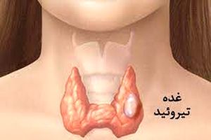 اگر کم کاری تیروئید دارید بخوانید
