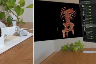 کاربرد ویژن پرو در رادیولوژی