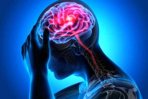 علائم سکته مغزی قریب الوقوع