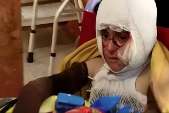 کیان برادر رایان کوچکترین شهید ایران؛ کودکی که دست‌هایش از سوختگی توان ندارند