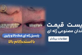 قیمت دندان مصنوعی
