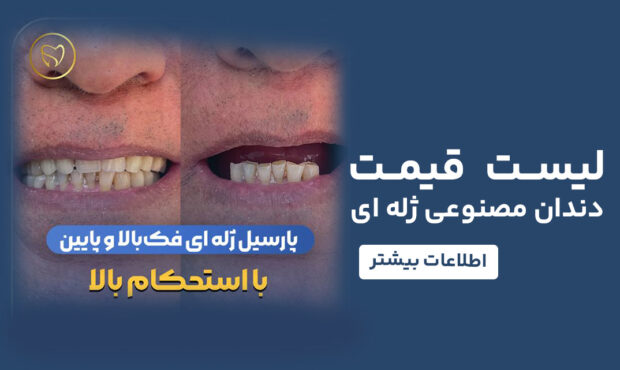 قیمت دندان مصنوعی