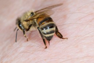 درمان سرطان پستان با زهر زنبور عسل_آفتاب شرق 8 زنبور عسل