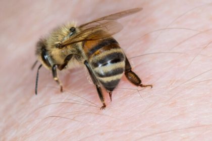 درمان سرطان پستان با زهر زنبور عسل_آفتاب شرق 10 زنبور عسل