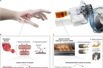 عضله رباتیک
