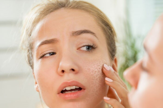 راه حلهای طبیعی برای از بین بردن خشکی پوست در دوران بارداری_آفتاب شرق 7 download (7)