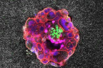 اولین ویدیو از لحظه حیرت‌انگیز کاشته‌شدن جنین در رحم را ببنیید + ویدیو