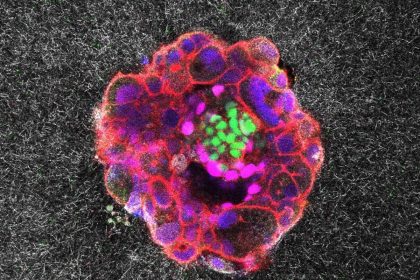 اولین ویدیو از لحظه حیرت‌انگیز کاشته‌شدن جنین در رحم را ببنیید + ویدیو