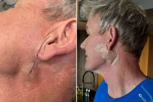 از آشپزخانه تا اتاق عمل؛ جدال سرآشپز جنجالی با سرطان_آفتاب شرق 6 از آشپزخانه تا اتاق عمل؛ جدال سرآشپز جنجالی با سرطان