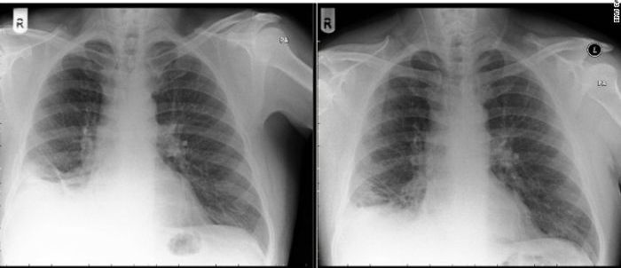 1757005899 518 ۴۰ سال یک اسباب‌بازی در ریه آفتاب شرق