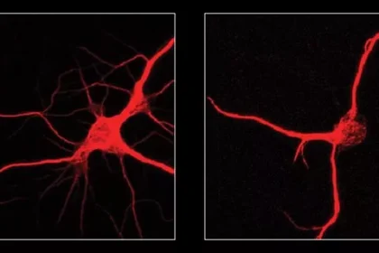 محققان با خاموش‌کردن یک پروتئین، پیری مغز را در موش‌ها معکوس کردند