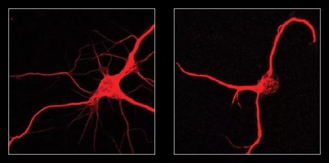 محققان با خاموش‌کردن یک پروتئین، پیری مغز را در موش‌ها معکوس کردند