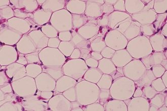 «اسفنج‌های خوراکی» که چربی را جذب می‌کنند