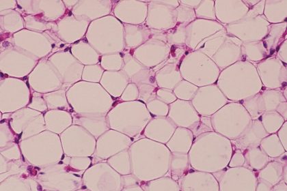 «اسفنج‌های خوراکی» که چربی را جذب می‌کنند