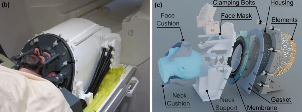 کلاه فراصوت برای تحریک مغز
