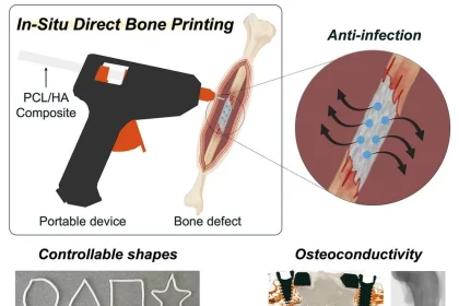 چاپ سه‌بعدی استخوان
