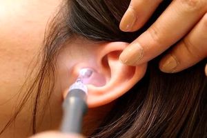 سرطان لاله گوش چیست و چه علائمی دارد؟_آفتاب شرق 5 سرطان لاله گوش چیست و چه علائمی دارد؟