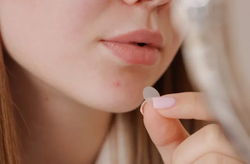 پچ‌های ضد جوش