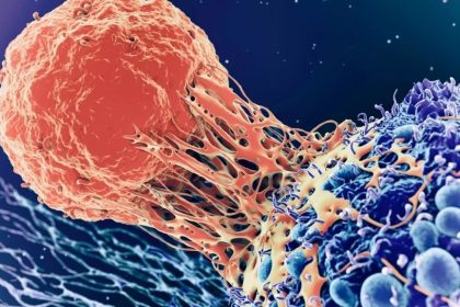 مرگ ناشی از سرطان تا ۲۵ سال آینده ۷۵ درصد افزایش مییابد_آفتاب شرق 6 مرگ ناشی از سرطان