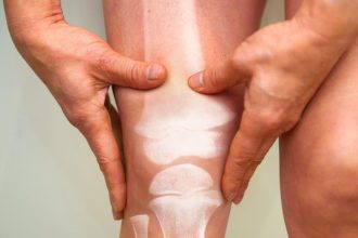 کاهش درد آرتروز