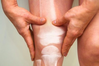 کاهش درد آرتروز
