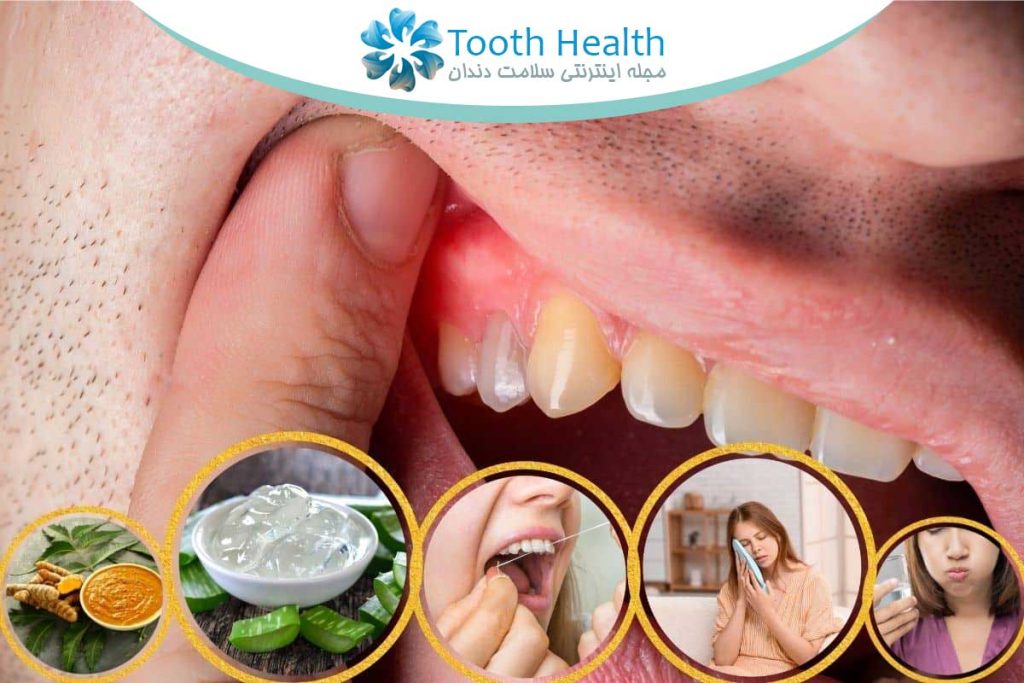 لبخندی که همه چیز رو تغییر میده؛ راهنمای کامل مراقبت و درمان های دندانپزشکی 8 لبخندی که همه چیز رو تغییر میده؛ راهنمای کامل مراقبت و درمان های دندانپزشکی