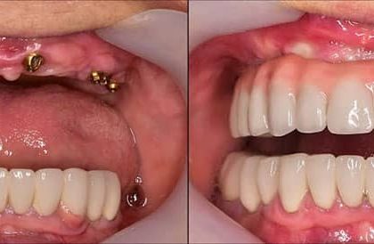 آینده دندانپزشکی