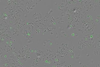 خودکشی سلول‌های سرطانی با باکتری