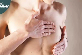 سرطان سینه در آقایان