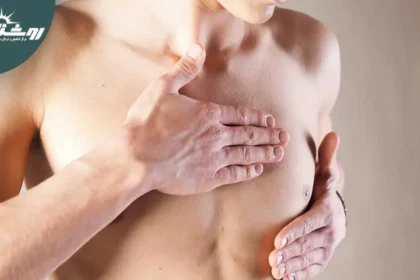 سرطان سینه در آقایان