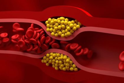 قرص کلسترول