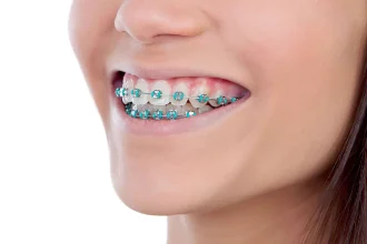 آیا ارتودنسی فقط برای داشتن لبخندی زیباتر است؟ حقیقتی که بسیاری از بیماران نمی‌دانند