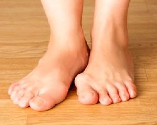 علائم نقرس را بشناسید