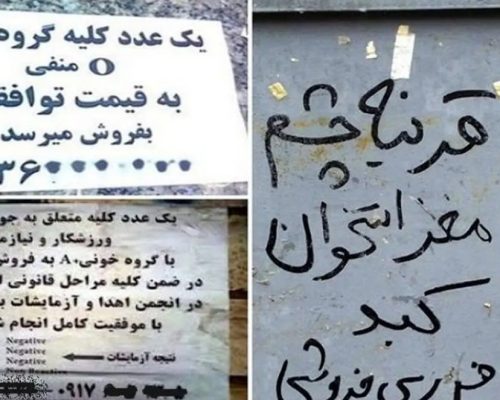 قیمت جان؛ کبد و کلیه ۴۰۰ میلیون تومان!