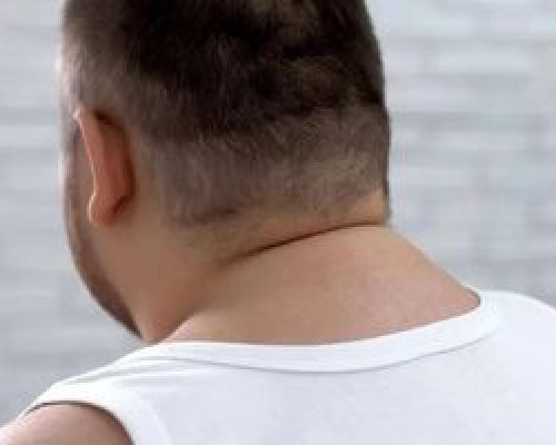 اندازه گردن چه چیزی در مورد سلامتی شما می‌گوید؟