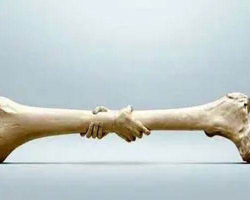 راه حل جدید‌ برای درمان پوکی استخوان