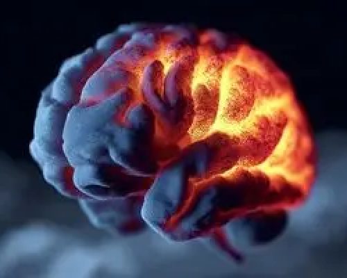 یک بیماری خاموش مغزی خطر زوال عقل را ۴ برابر می‌کند