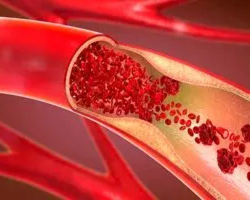 روش های اورژانسی پیشگیری از خونریزی در مجروحان