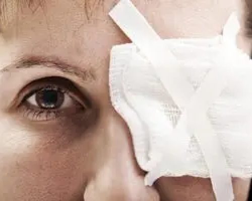 آسیب های چشمی در انفجار و حملات؛ نکات ضروری کمک های اولیه