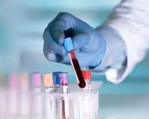 حذف یک آزمایش مهم از پوشش بیمه