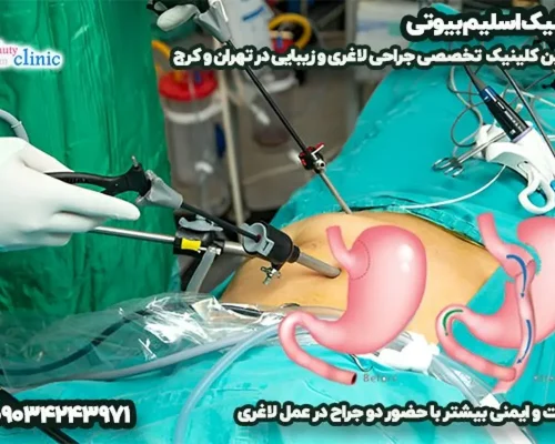 کلینیک اسلیم بیوتی؛ پیشرو در جراحی‌های لاغری و زیبایی