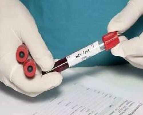 آیا لیزر باعث انتقال HPV می شود؟