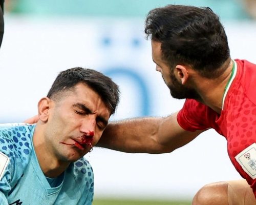 امید در اردوی پرسپولیس/ بیرانوند یک‌شنبه تست می‌دهد