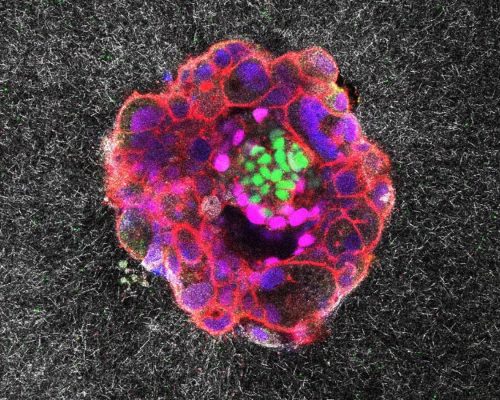 اولین ویدیو از لحظه حیرت‌انگیز کاشته‌شدن جنین در رحم را ببنیید + ویدیو