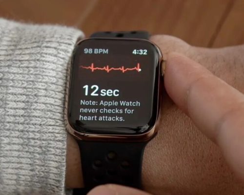 ویژگی ECG اپل واچ