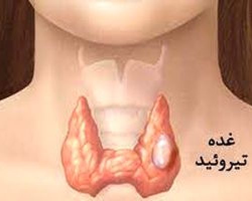 اگر کم کاری تیروئید دارید بخوانید