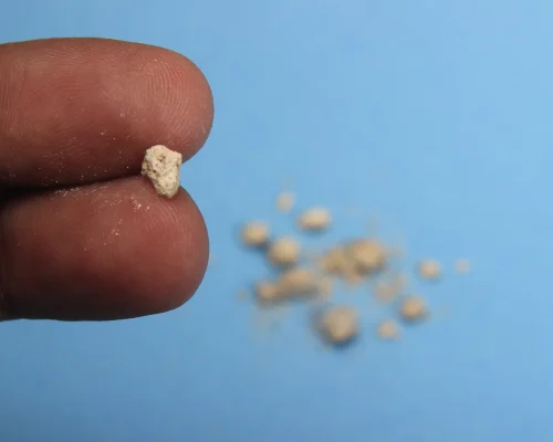 kidney stone