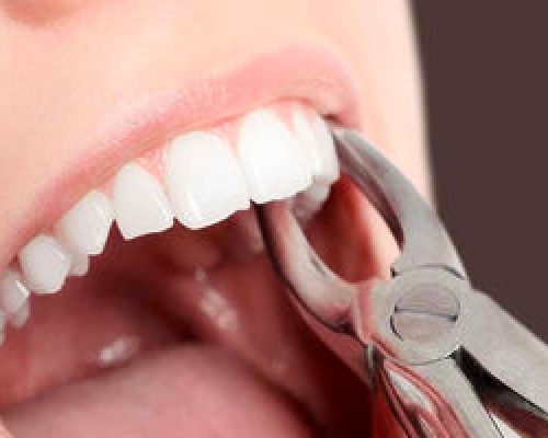 خرید و فروش دندان‌های پوسیده!