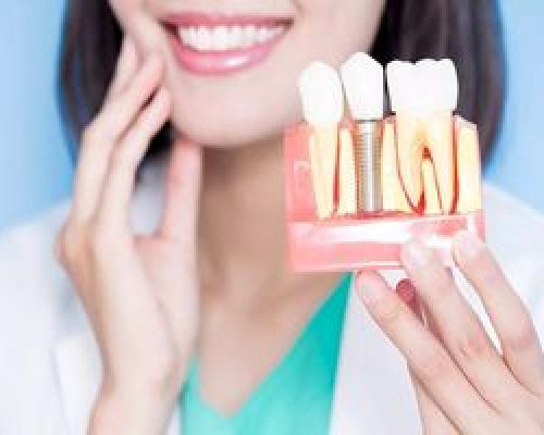 راهنمای جامع برای انتخاب بهترین گزینه
