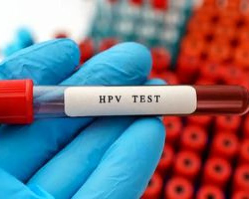 زگیل تناسلی؛ بیماری خاموش اما شایع/ 80 درصد مردم جهان حداقل یک نوع از ویروس HPV را تجربه می کنند